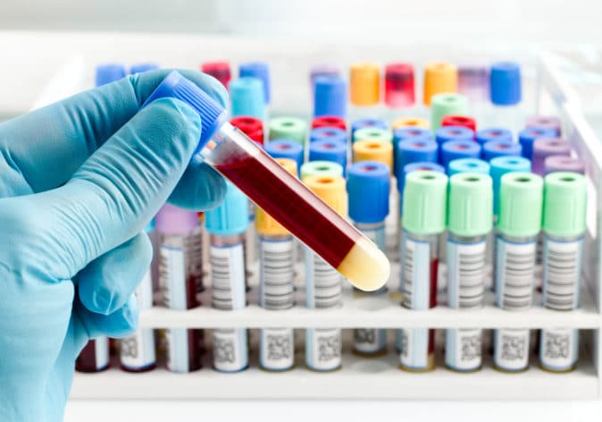 How Bloodwork Is Used In Cancer Care (Liquid Biopsy)