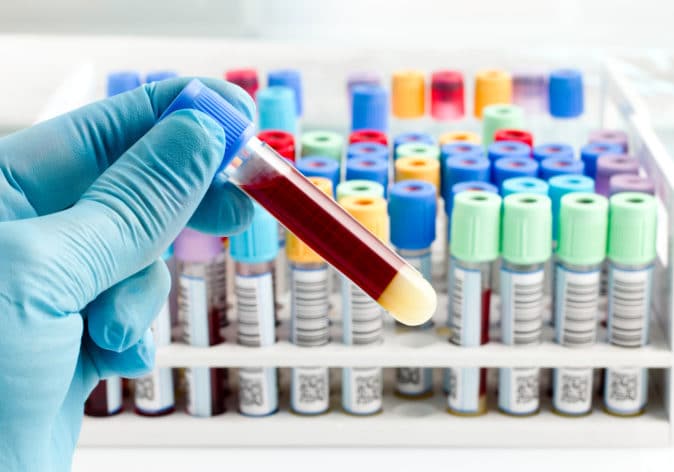 how bloodwork is used in cancer care (liquid biopsy)