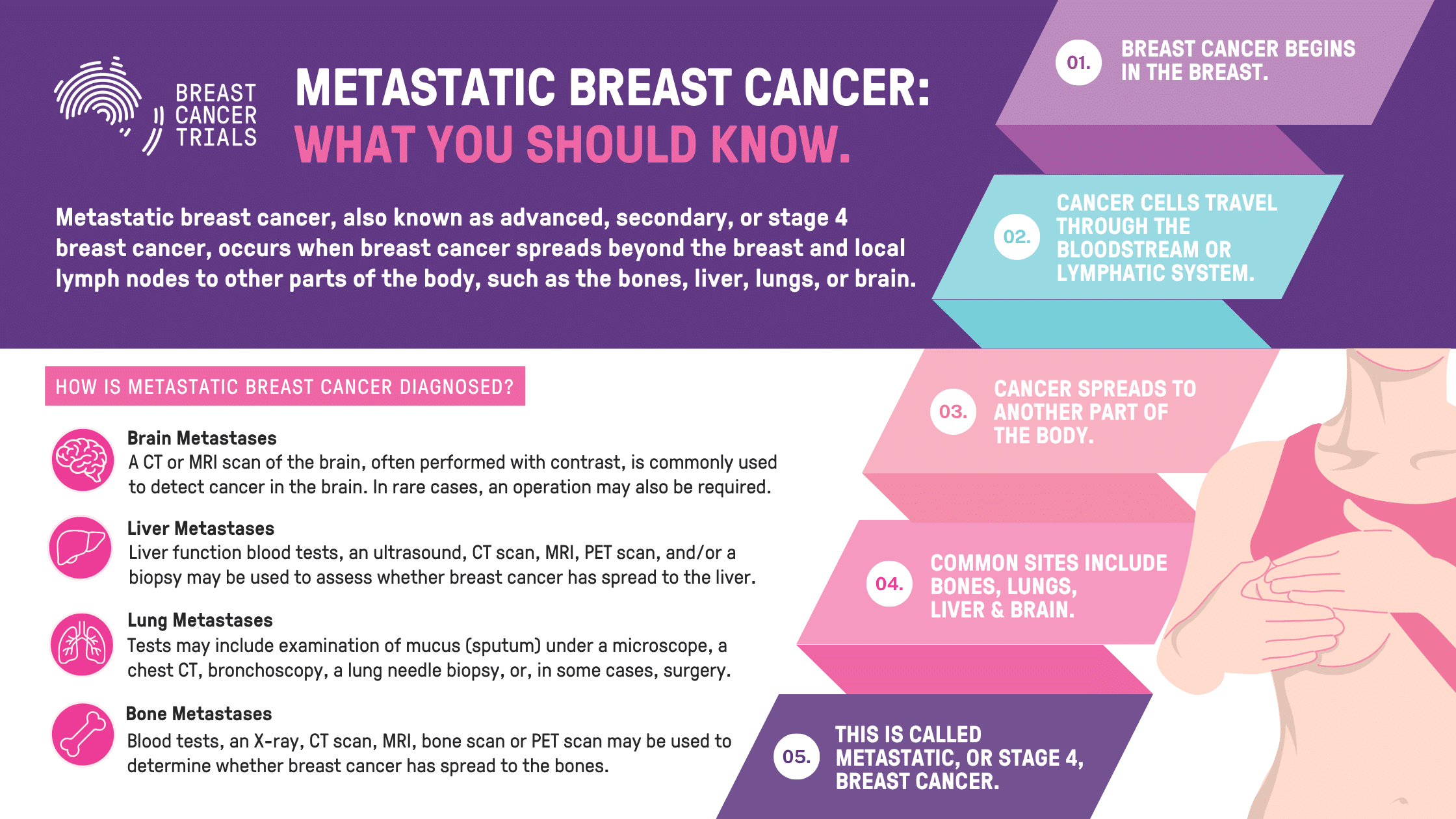metastatic breast cancer infographic | 1